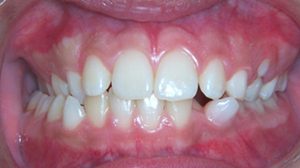 dental-midlines